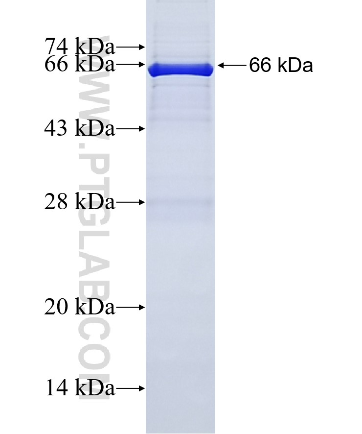 SCOT fusion protein Ag2818 SDS-PAGE