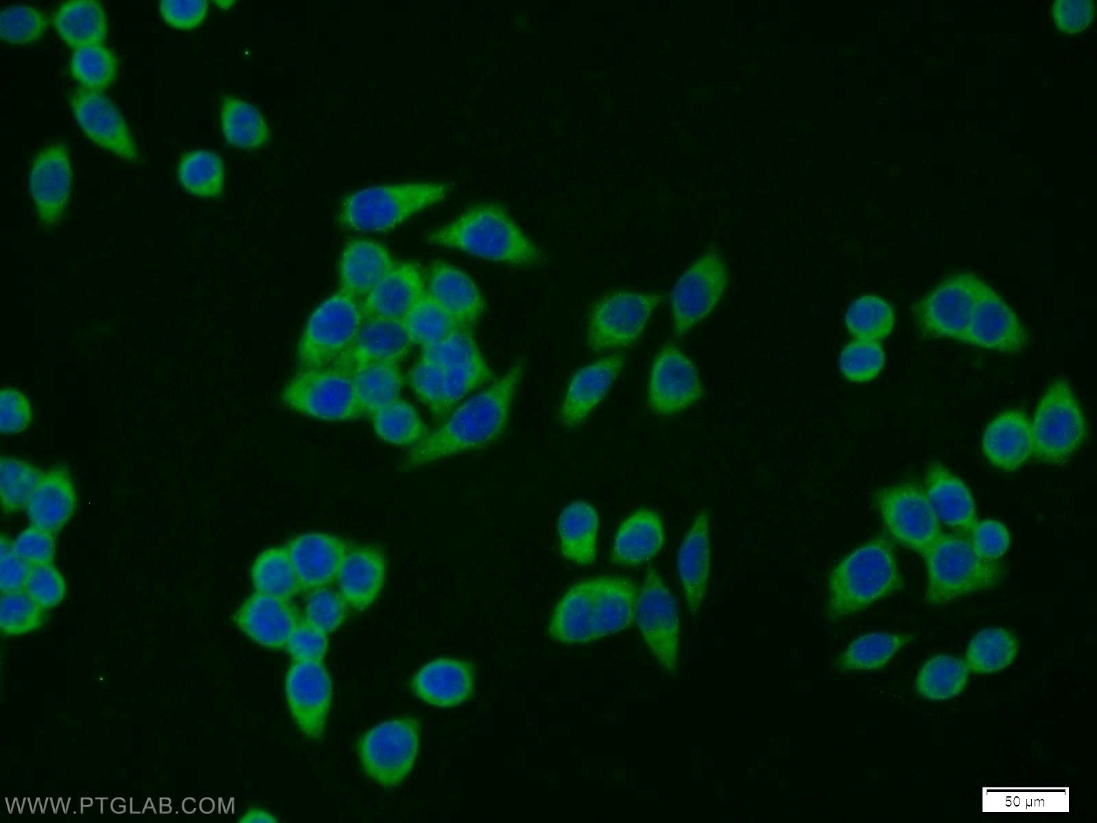 IF Staining of BxPC-3 using 14397-1-AP