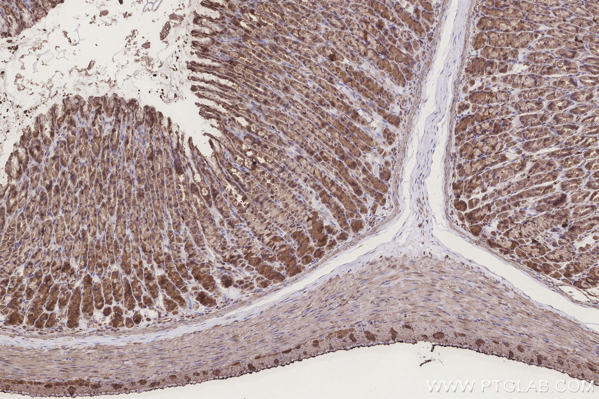 IHC staining of rat stomach using 23006-1-AP IHC staining of rat stomach using 23006-1-AP