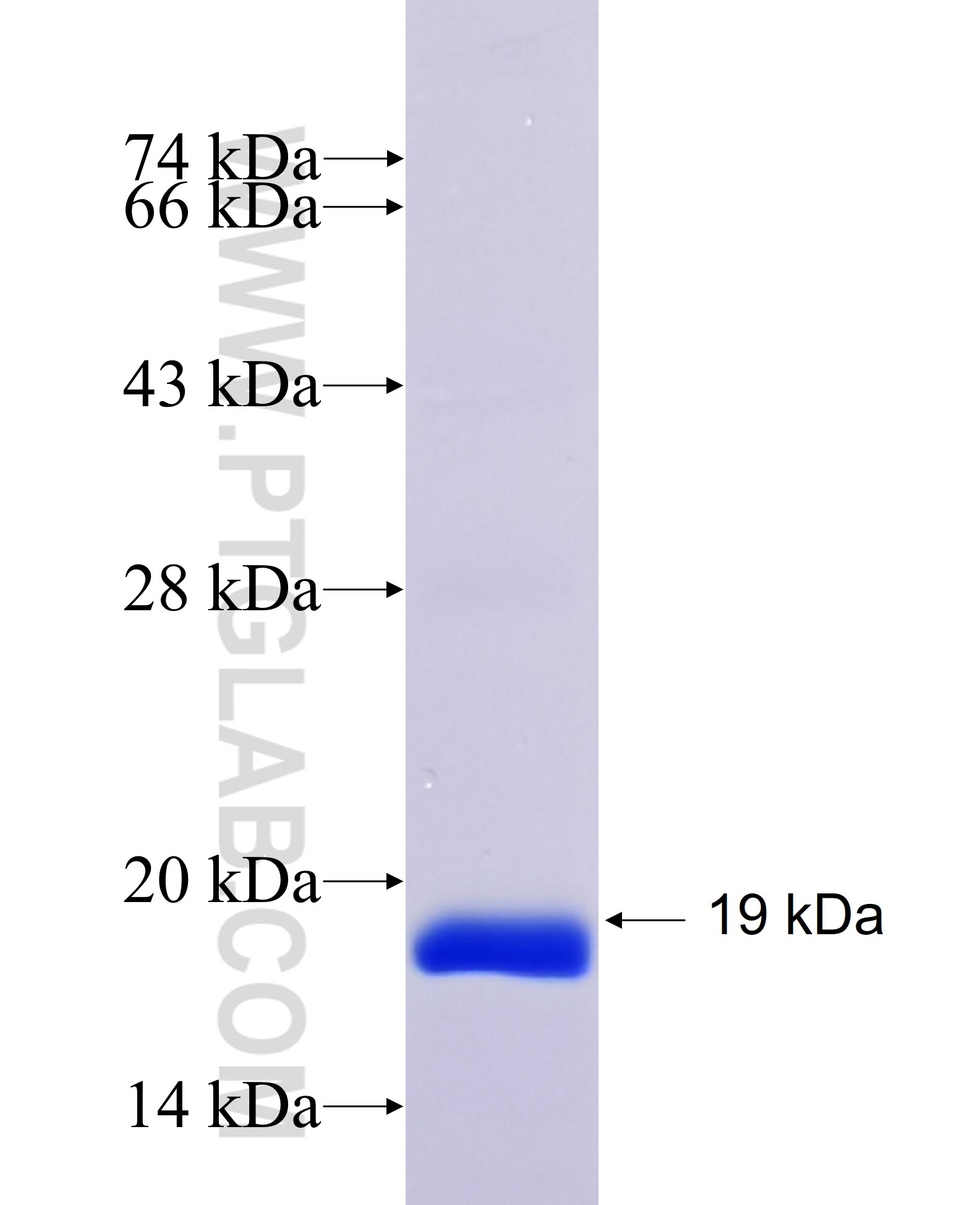 SCP2 fusion protein Ag19261 SDS-PAGE