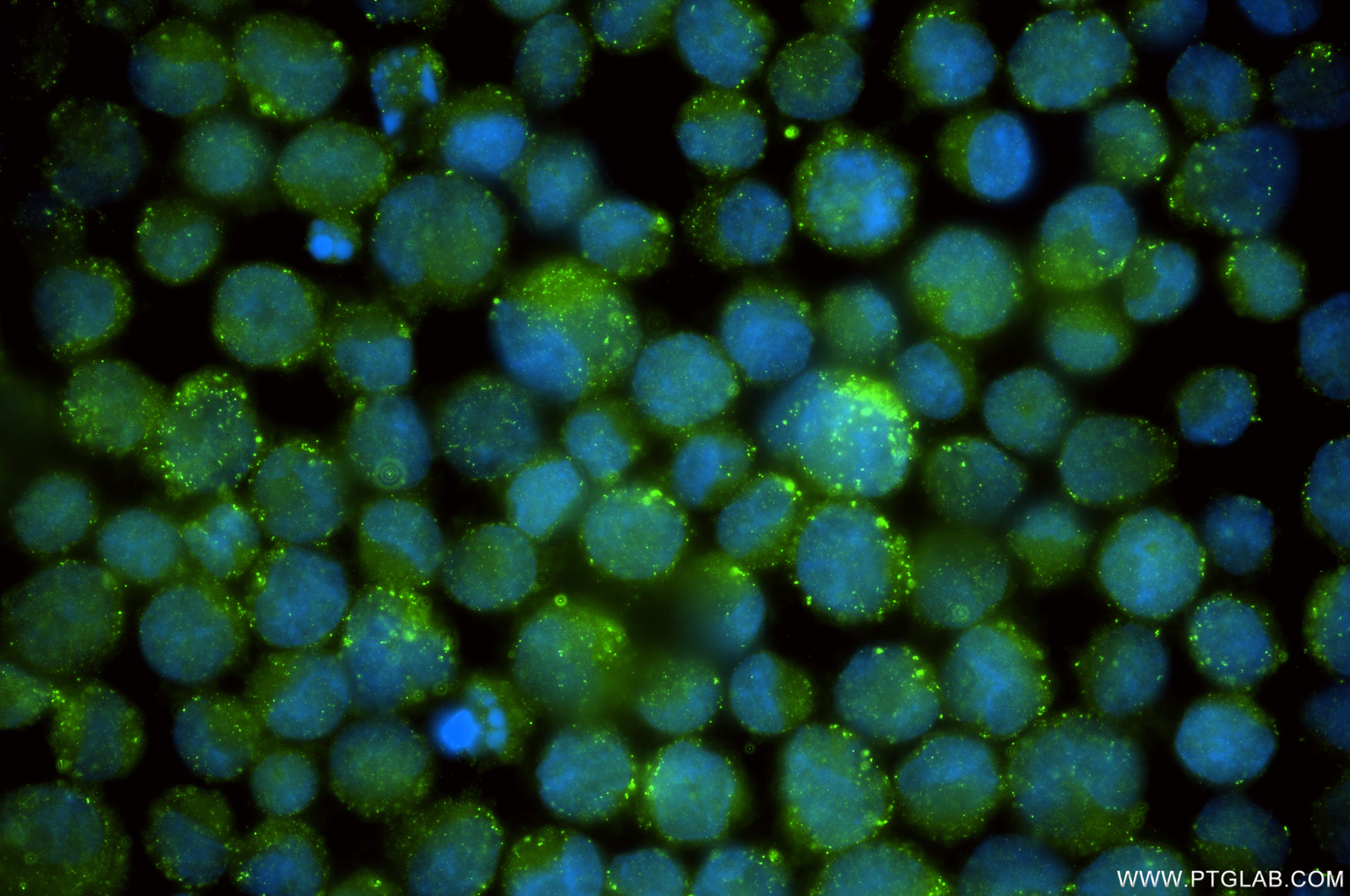 IF Staining of k562 using 86196-3-RR