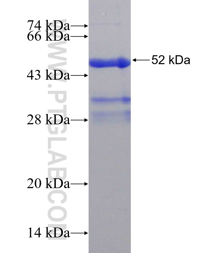 SCPEP1 fusion protein Ag31381 SDS-PAGE