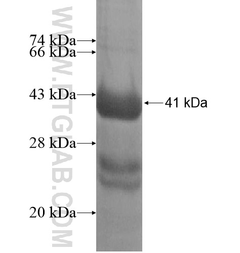 SCPEP1 fusion protein Ag11931 SDS-PAGE SCPEP1 fusion protein Ag11931 SDS-PAGE