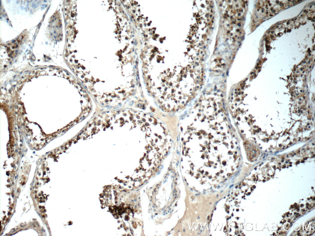 IHC staining of human testis using 14038-1-AP