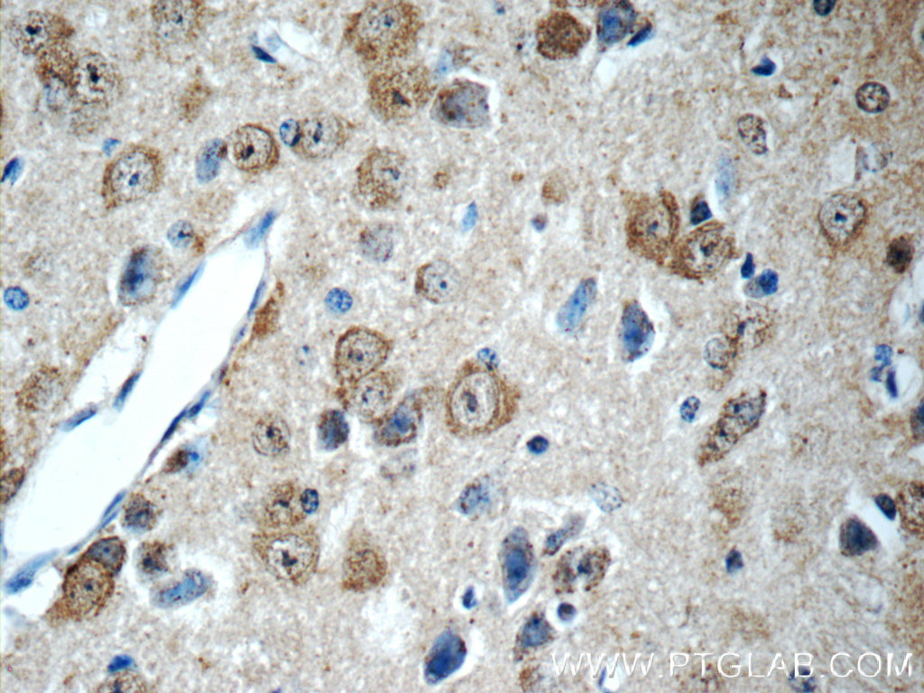 IHC staining of mouse brain using 14038-1-AP