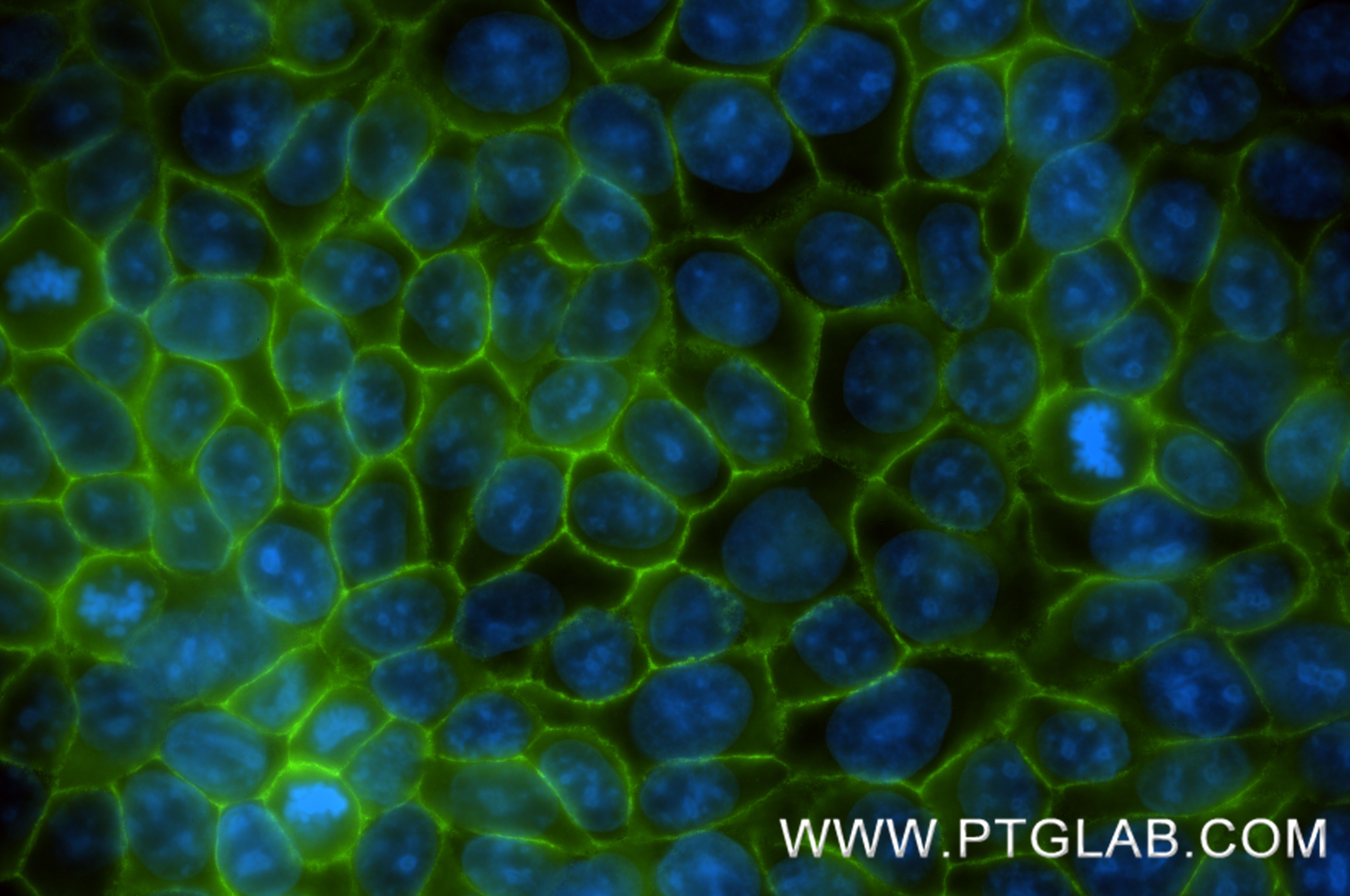 IF Staining of MCF-7 using 87069-3-RR (same clone as 87069-3-PBS) IF Staining of MCF-7 using 87069-3-RR (same clone as 87069-3-PBS)