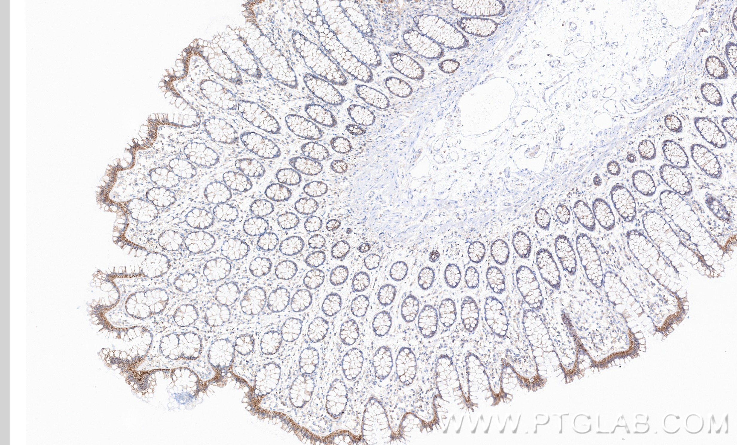 IHC staining of human large intestine using 87069-3-RR (same clone as 87069-3-PBS) IHC staining of human large intestine using 87069-3-RR (same clone as 87069-3-PBS)