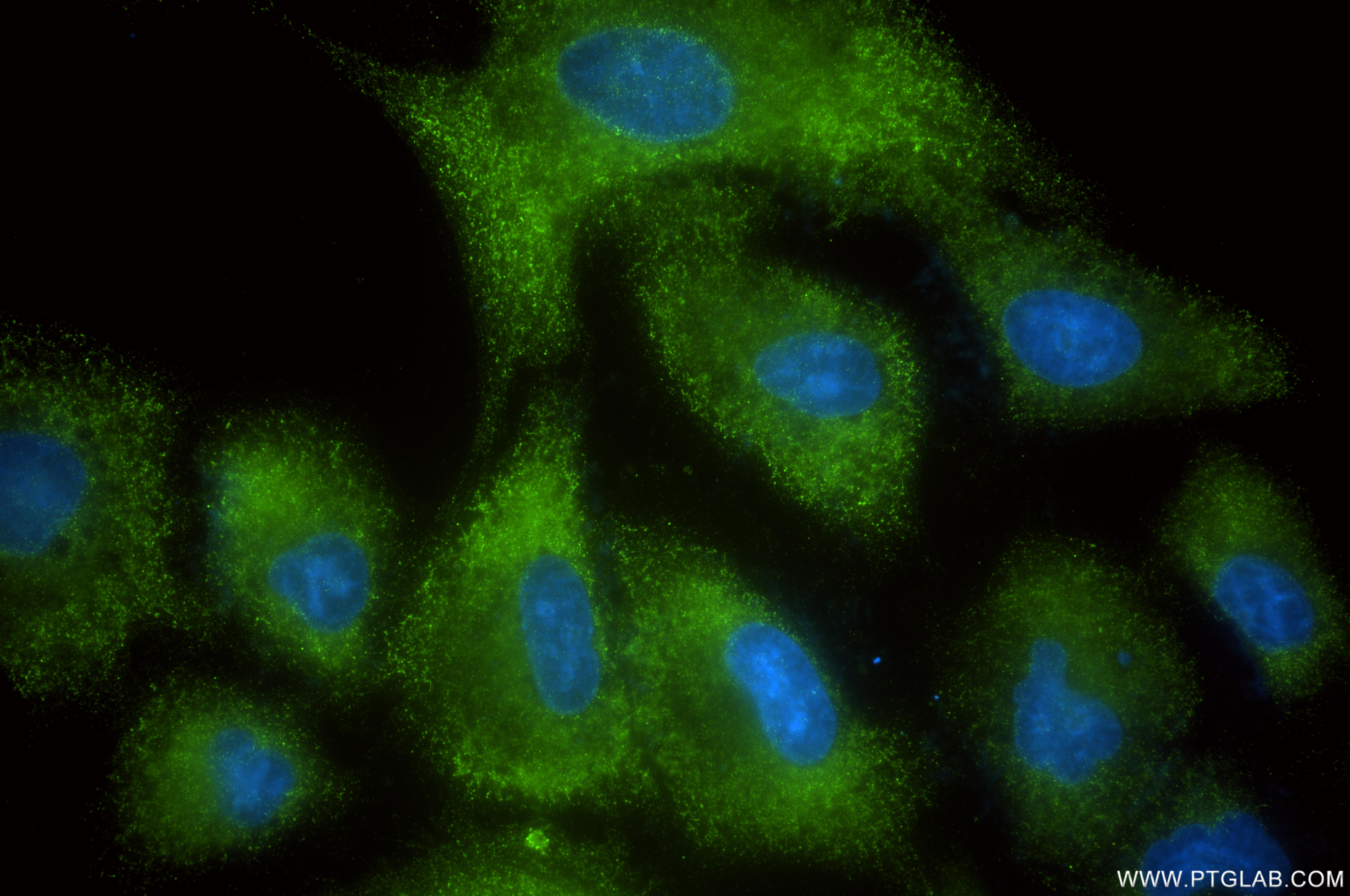Immunofluorescent analysis of (-20°C Ethanol) fixed A549 cells using SCRN1 antibody (<a class='green' href='/productredirect?CatalogNo=86646-1-RR' target='_blank'>86646-1-RR</a>, Clone: 251548C7 ) at dilution of 1:400 and CoraLite®488-Conjugated Goat Anti-Rabbit IgG(H+L) (<a class='green' href='/productredirect?CatalogNo=SA00013-2' target='_blank'>SA00013-2</a>). This data was developed using the same antibody clone with 86646-1-PBS in a different storage buffer formulation. IF Staining of A549 using 86646-1-RR (same clone as 86646-1-PBS)
