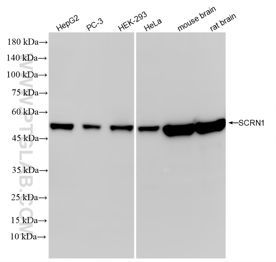 Various lysates were subjected to SDS PAGE followed by western blot with <a class='green' href='/productredirect?CatalogNo=86646-1-RR' target='_blank'>86646-1-RR</a> (SCRN1 antibody) at dilution of 1:10000 incubated at room temperature for 1.5 hours. This data was developed using the same antibody clone with 86646-1-PBS in a different storage buffer formulation. WB analysis using 86646-1-RR (same clone as 86646-1-PBS)
