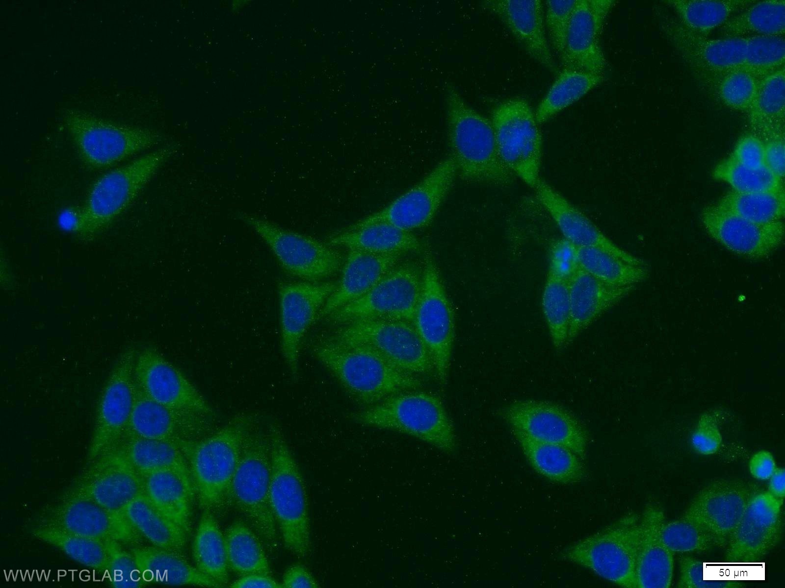 IF Staining of HepG2 using 13240-1-AP