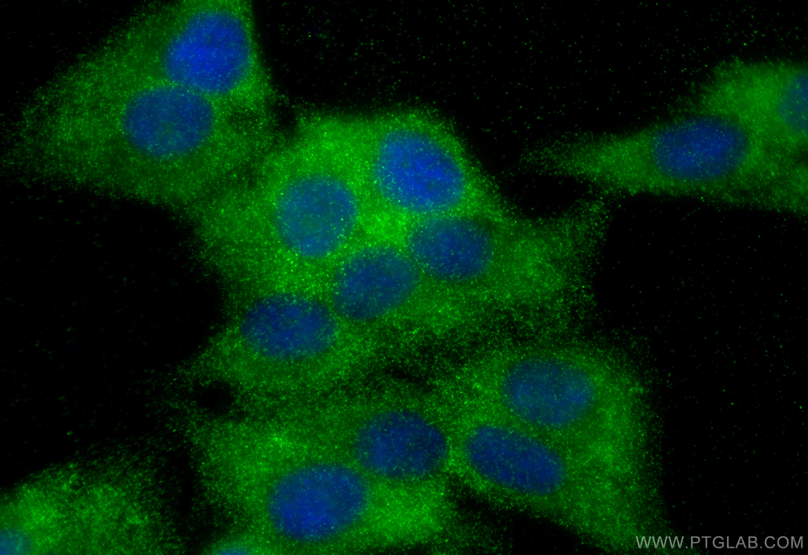 IF Staining of HepG2 using 13240-1-AP