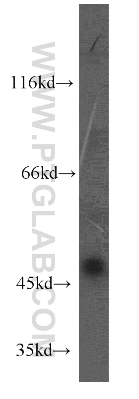 WB analysis of HepG2 using 13240-1-AP