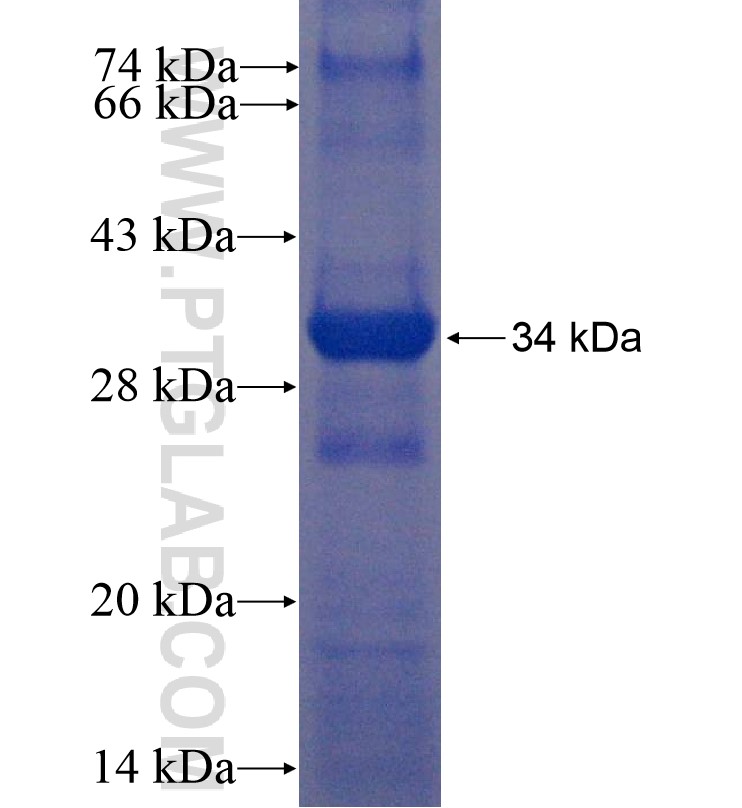 SCRN3 fusion protein Ag16486 SDS-PAGE SCRN3 fusion protein Ag16486 SDS-PAGE