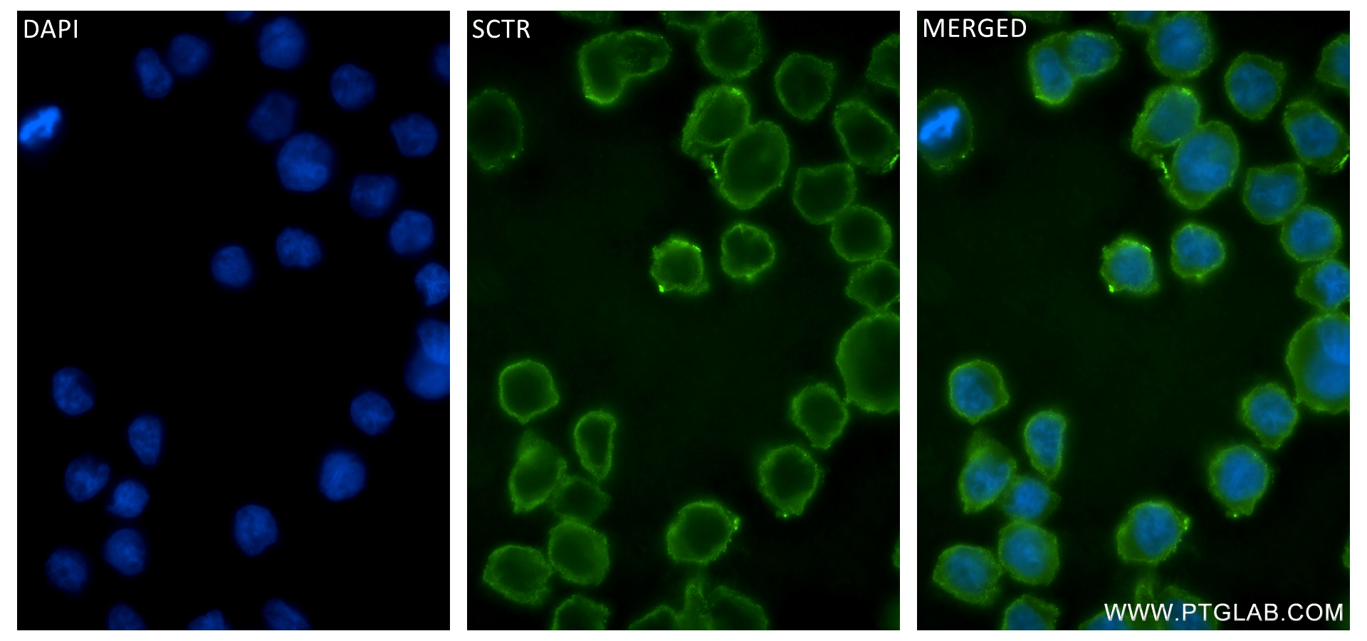 IF Staining of THP-1 using 83675-6-RR (same clone as 83675-6-PBS)