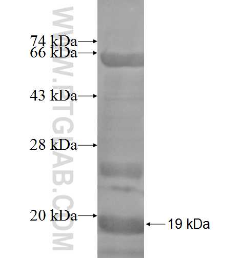 SCTR fusion protein Ag6094 SDS-PAGE SCTR fusion protein Ag6094 SDS-PAGE