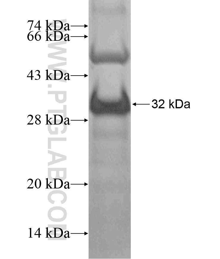 SCUBE2 fusion protein Ag17350 SDS-PAGE SCUBE2 fusion protein Ag17350 SDS-PAGE