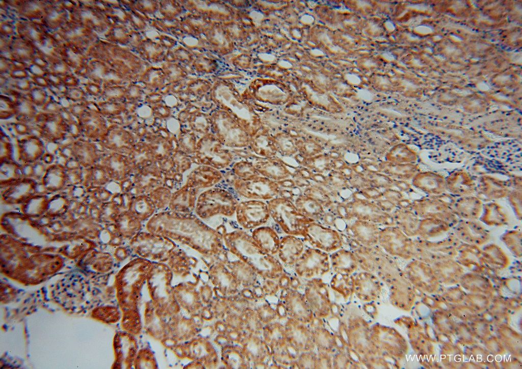 IHC staining of human kidney using 16773-1-AP