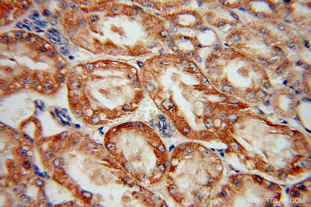 IHC staining of human kidney using 16773-1-AP