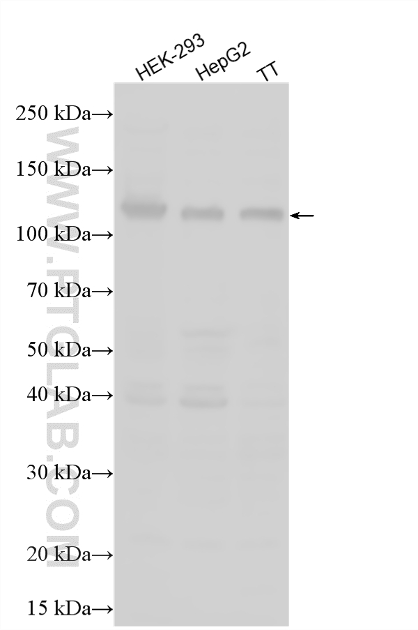 Various lysates were subjected to SDS PAGE followed by western blot with 16773-1-AP (SCUBE3 antibody) at dilution of 1:400 incubated at room temperature for 1.5 hours. WB analysis using 16773-1-AP