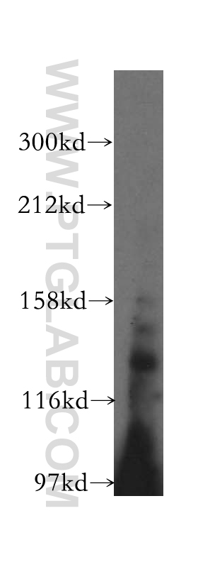 WB analysis of mouse kidney using 16773-1-AP