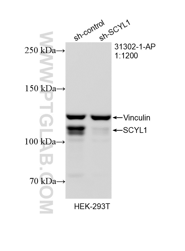 WB analysis of HEK-293T using 31302-1-AP