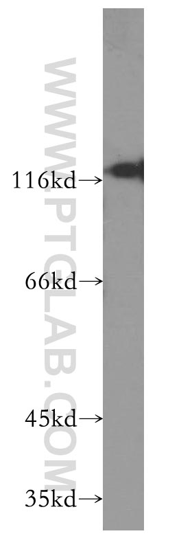 WB analysis of BxPC-3 using 60185-1-Ig