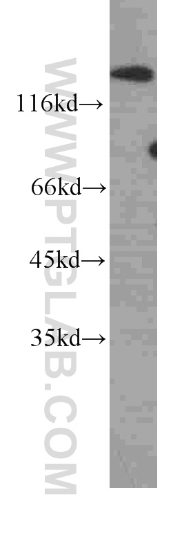 WB analysis of MCF-7 using 60185-2-Ig