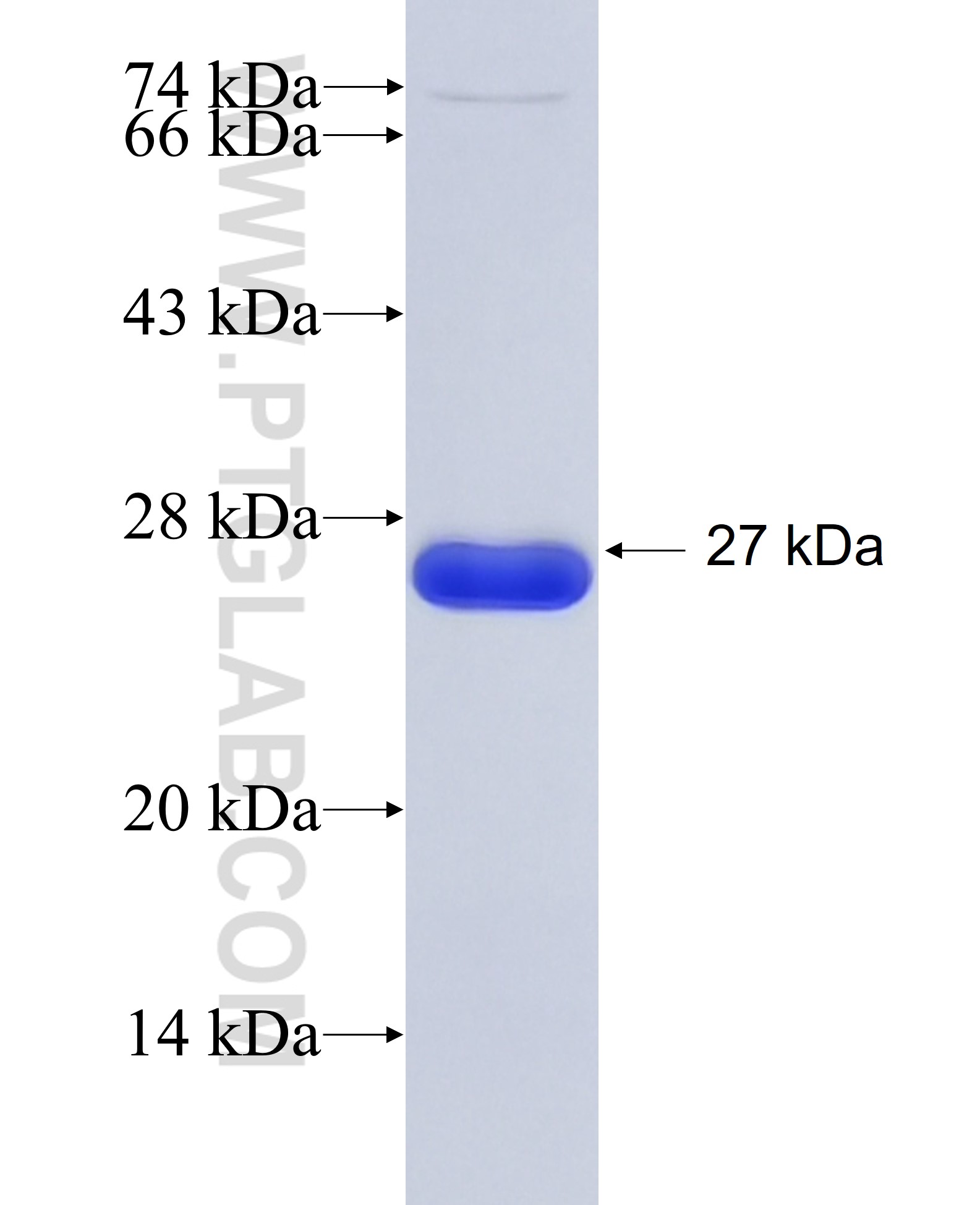 SDC2 fusion protein Ag5739 SDS-PAGE