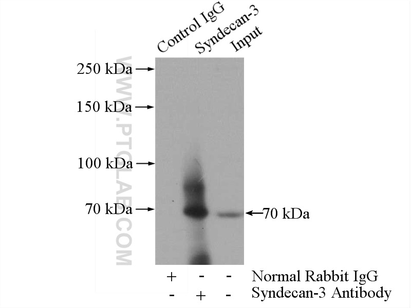 IP experiment of mouse lung using 10886-1-AP