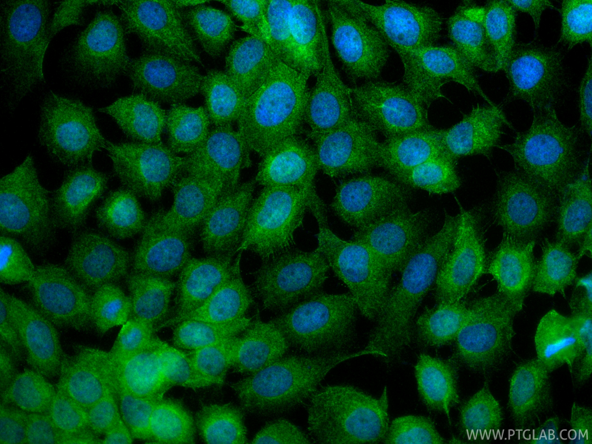 IF Staining of A431 using 11820-1-AP IF Staining of A431 using 11820-1-AP