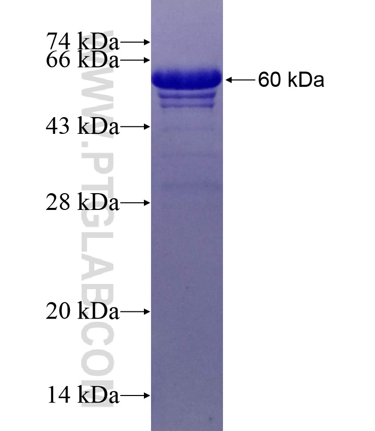 SDC4 fusion protein Ag26691 SDS-PAGE SDC4 fusion protein Ag26691 SDS-PAGE