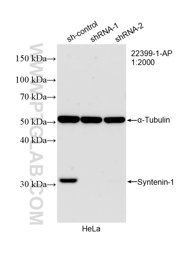 WB analysis of HeLa using 22399-1-AP WB analysis of HeLa using 22399-1-AP