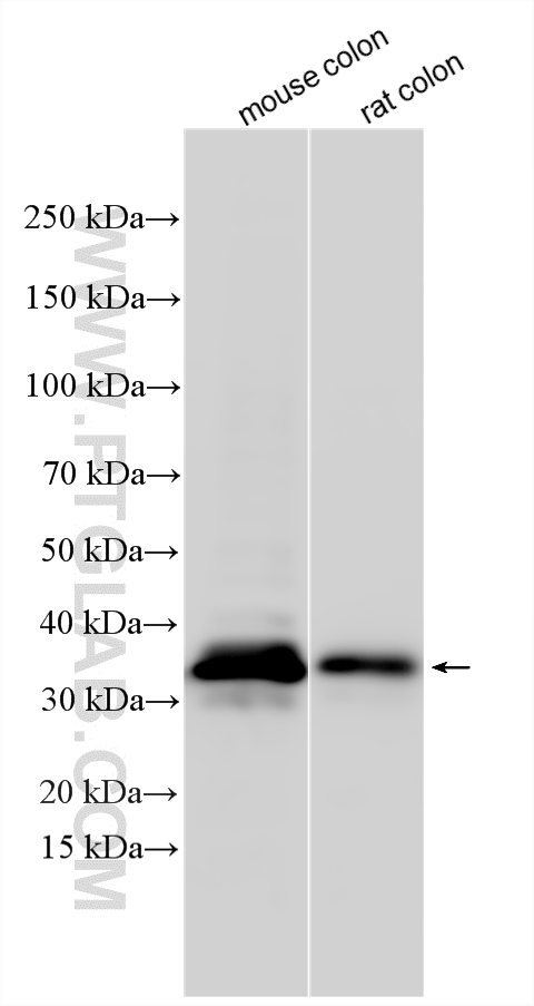 Various lysates were subjected to SDS PAGE followed by western blot with 10407-1-AP (Syntenin 2 antibody) at dilution of 1:2000 incubated at room temperature for 1.5 hours. WB analysis using 10407-1-AP