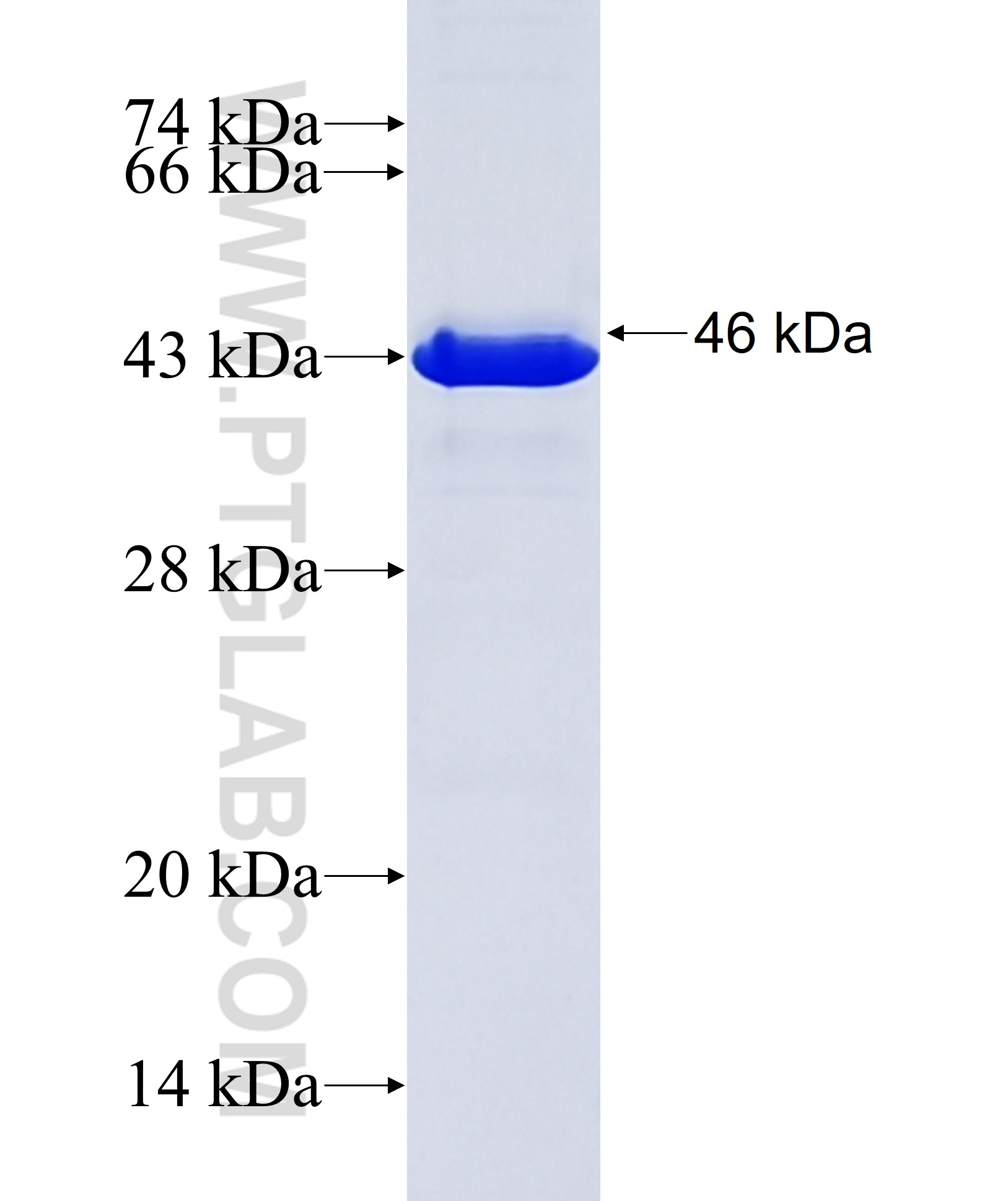 SDCCAG3 fusion protein Ag9093 SDS-PAGE SDCCAG3 fusion protein Ag9093 SDS-PAGE