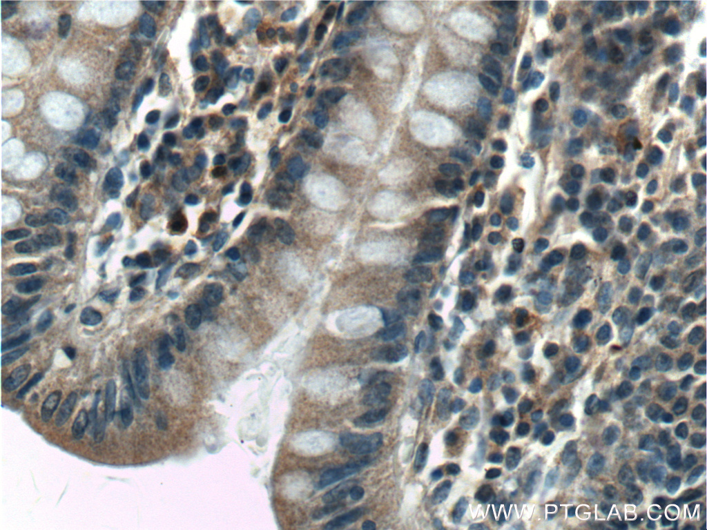 IHC staining of human colon using 13471-1-AP