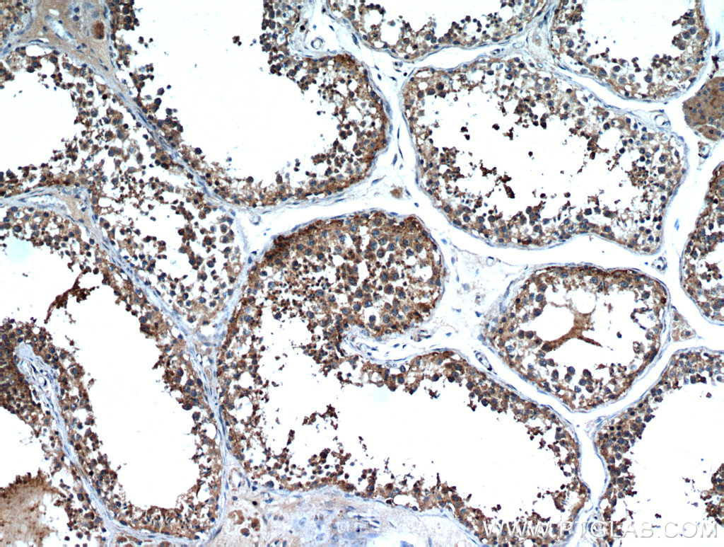 IHC staining of human testis using 20888-1-AP