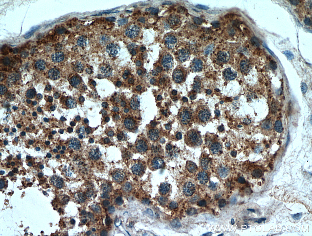 IHC staining of human testis using 20888-1-AP