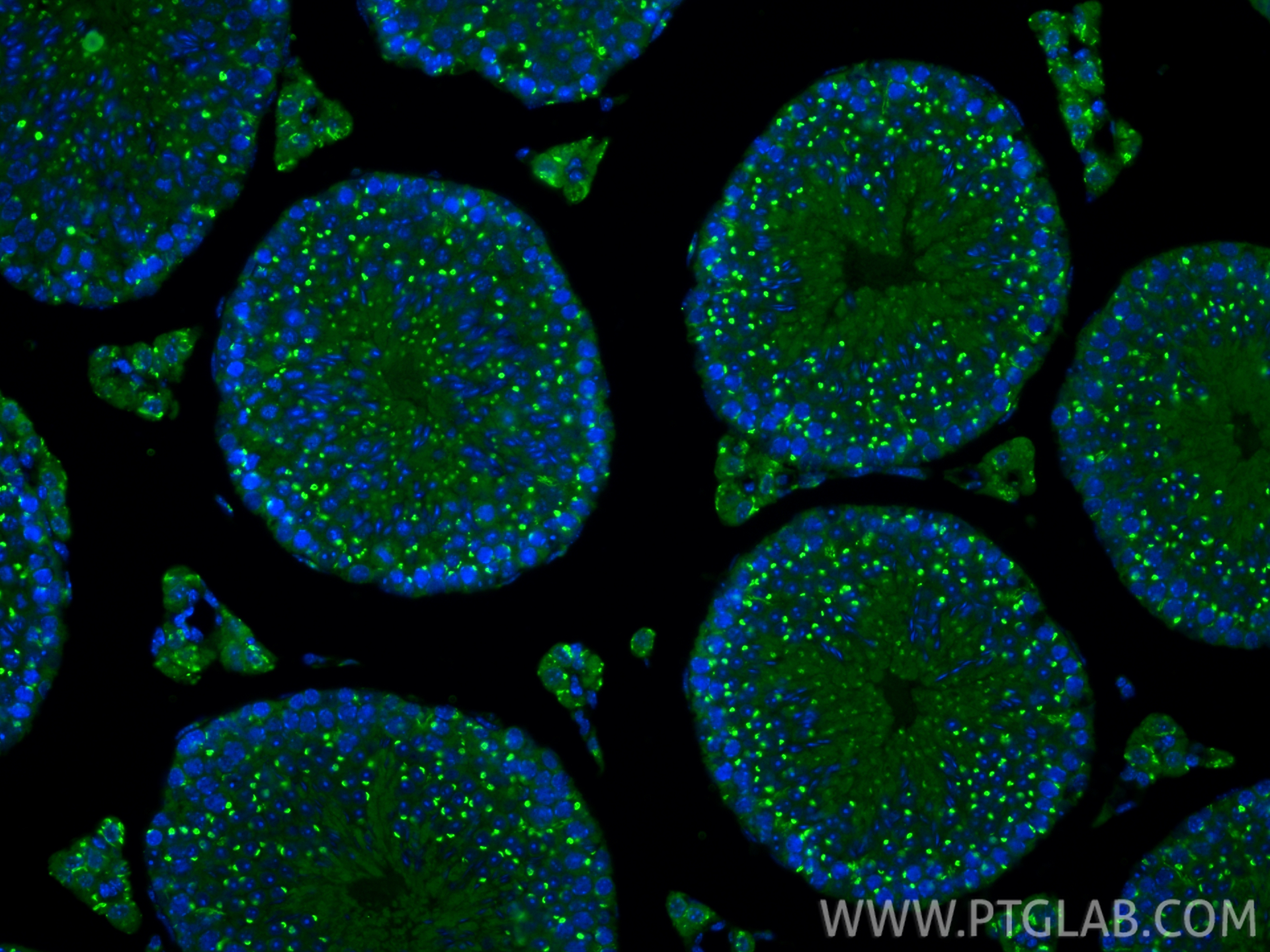 IF Staining of mouse testis using 10517-1-AP