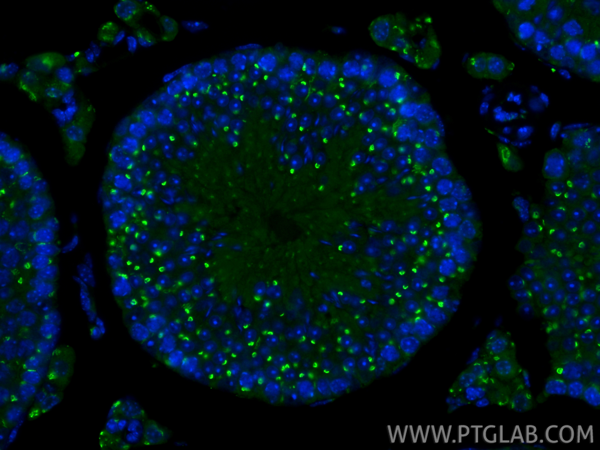 IF Staining of mouse testis using 10517-1-AP