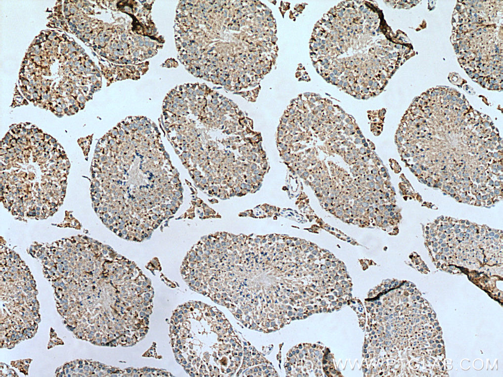 IHC staining of mouse testis using 10517-1-AP (same clone as 10517-1-PBS)