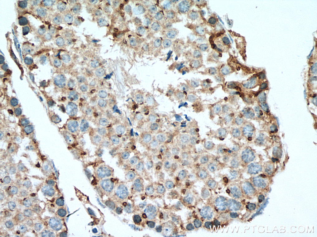 IHC staining of mouse testis using 10517-1-AP (same clone as 10517-1-PBS)