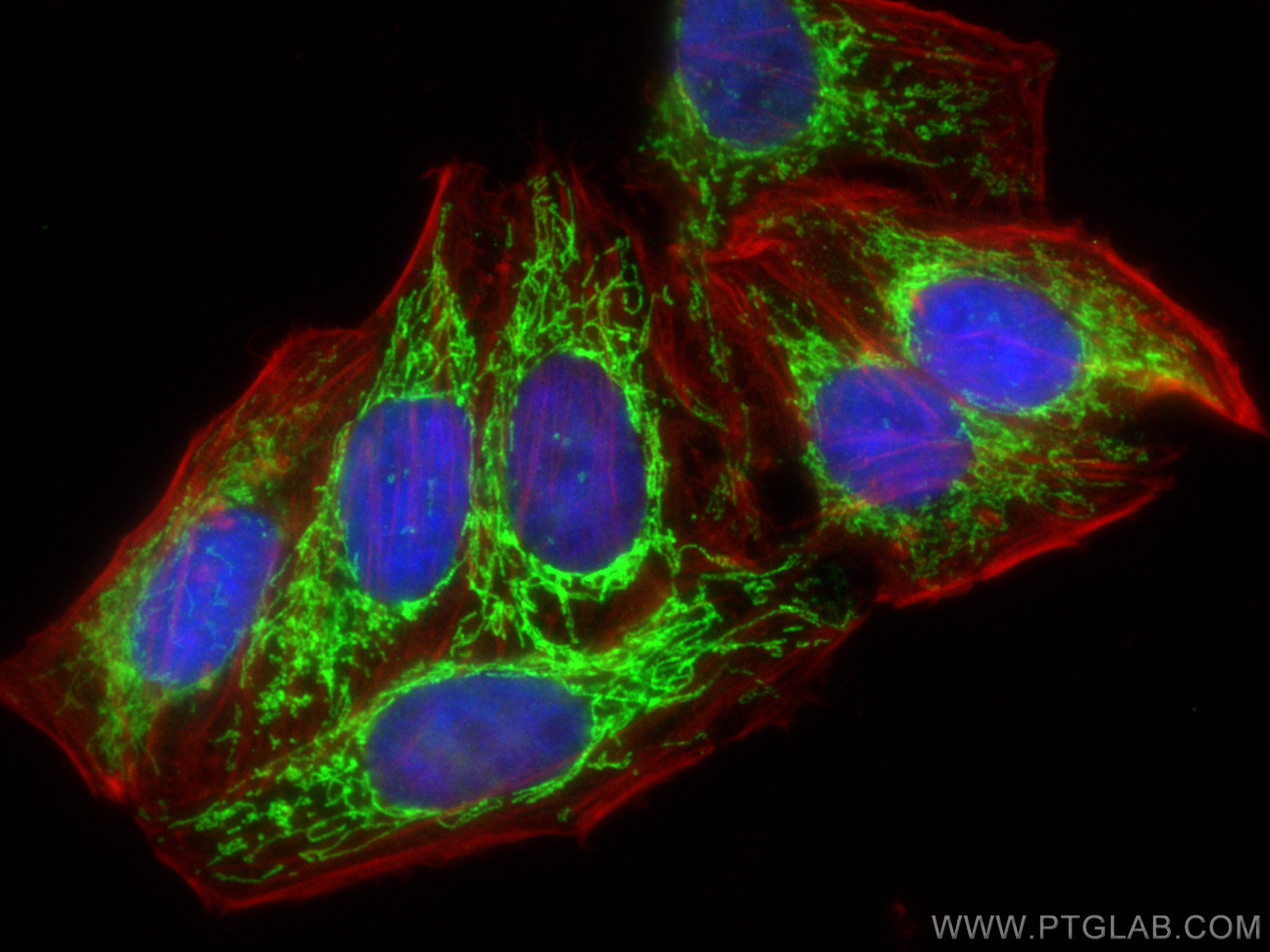 IF Staining of HepG2 using 14865-1-AP