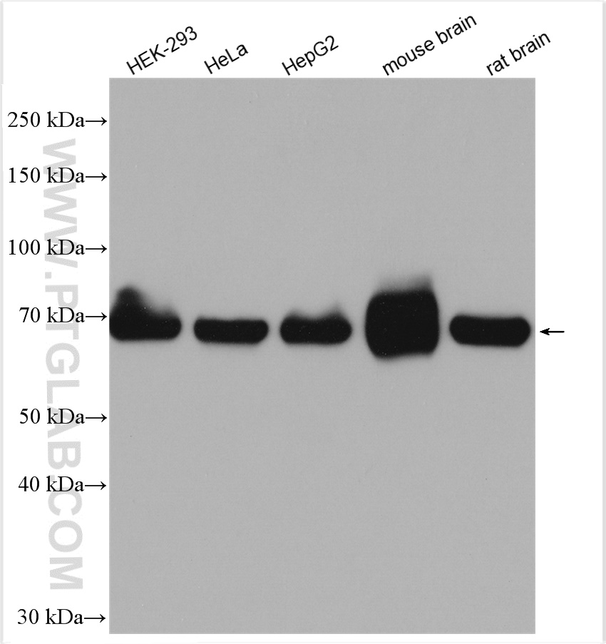 WB analysis using 14865-1-AP