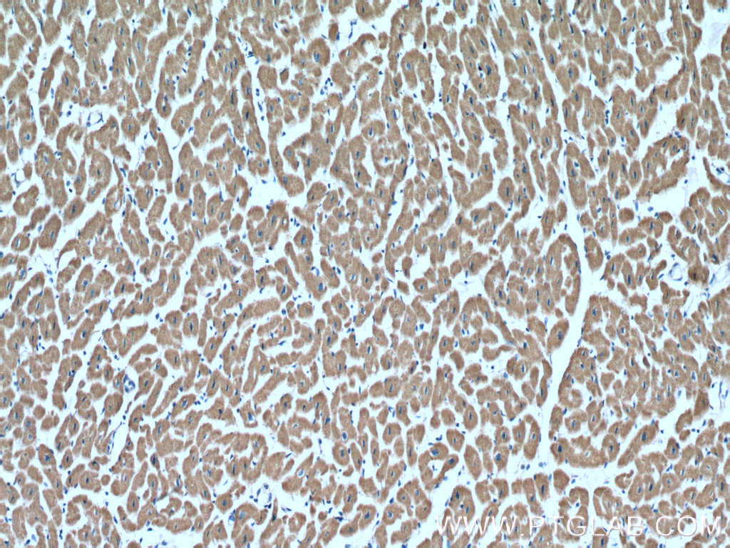 IHC staining of human heart using 10620-1-AP