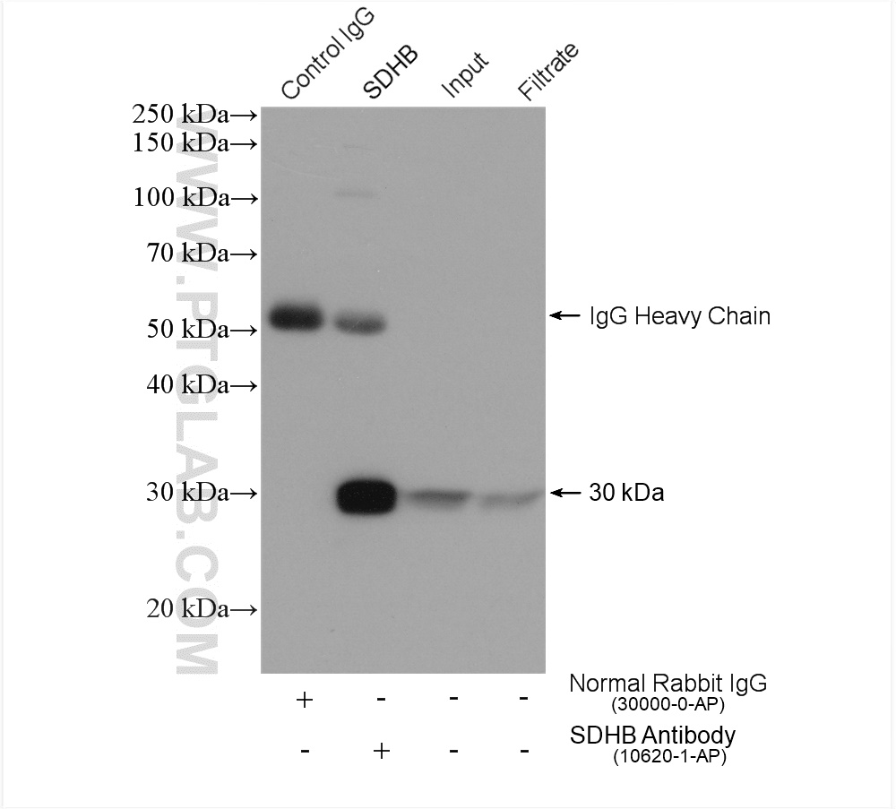 IP experiment of HEK-293 using 10620-1-AP