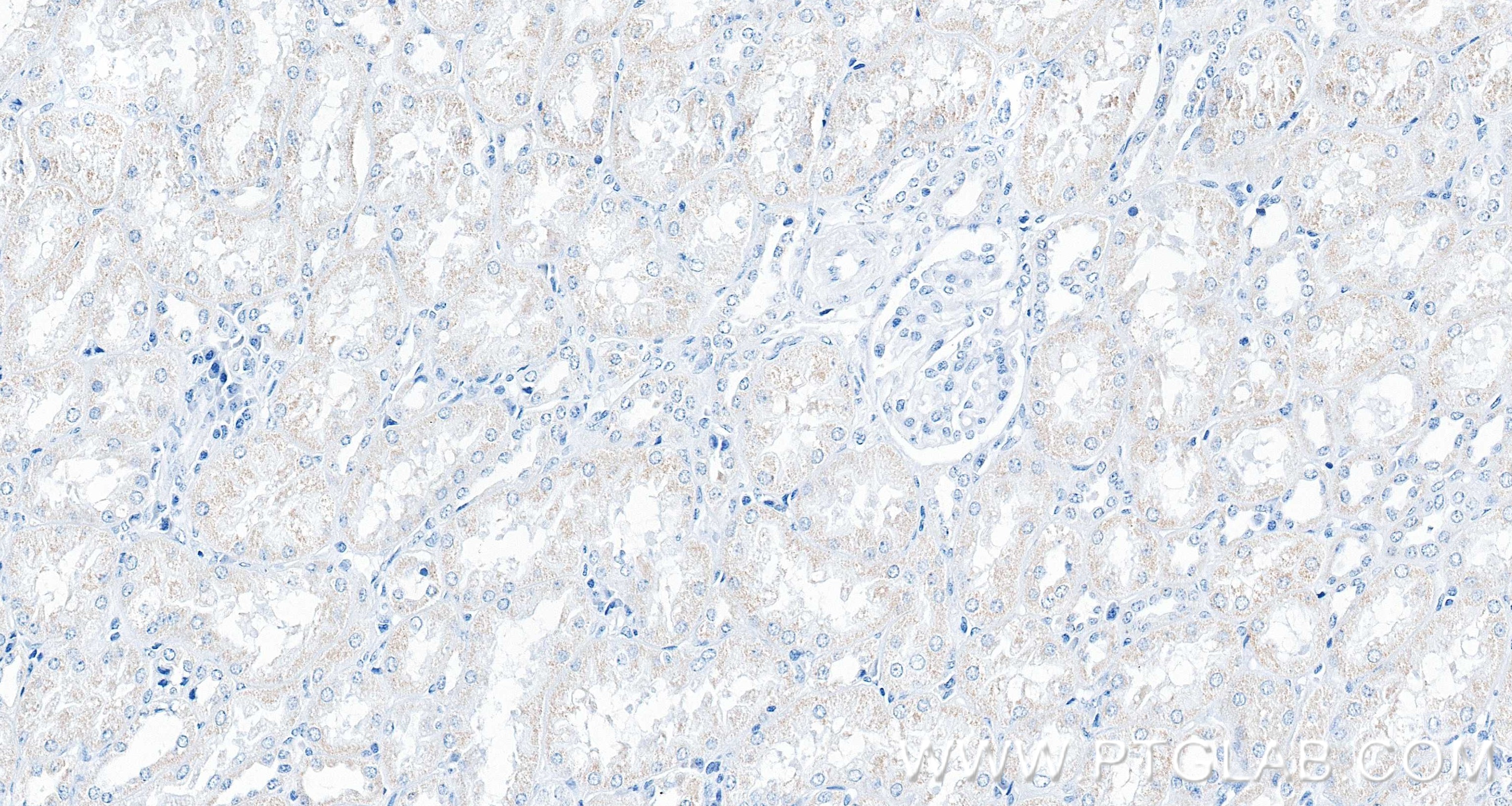 IHC staining of human kidney using 87791-1-RR