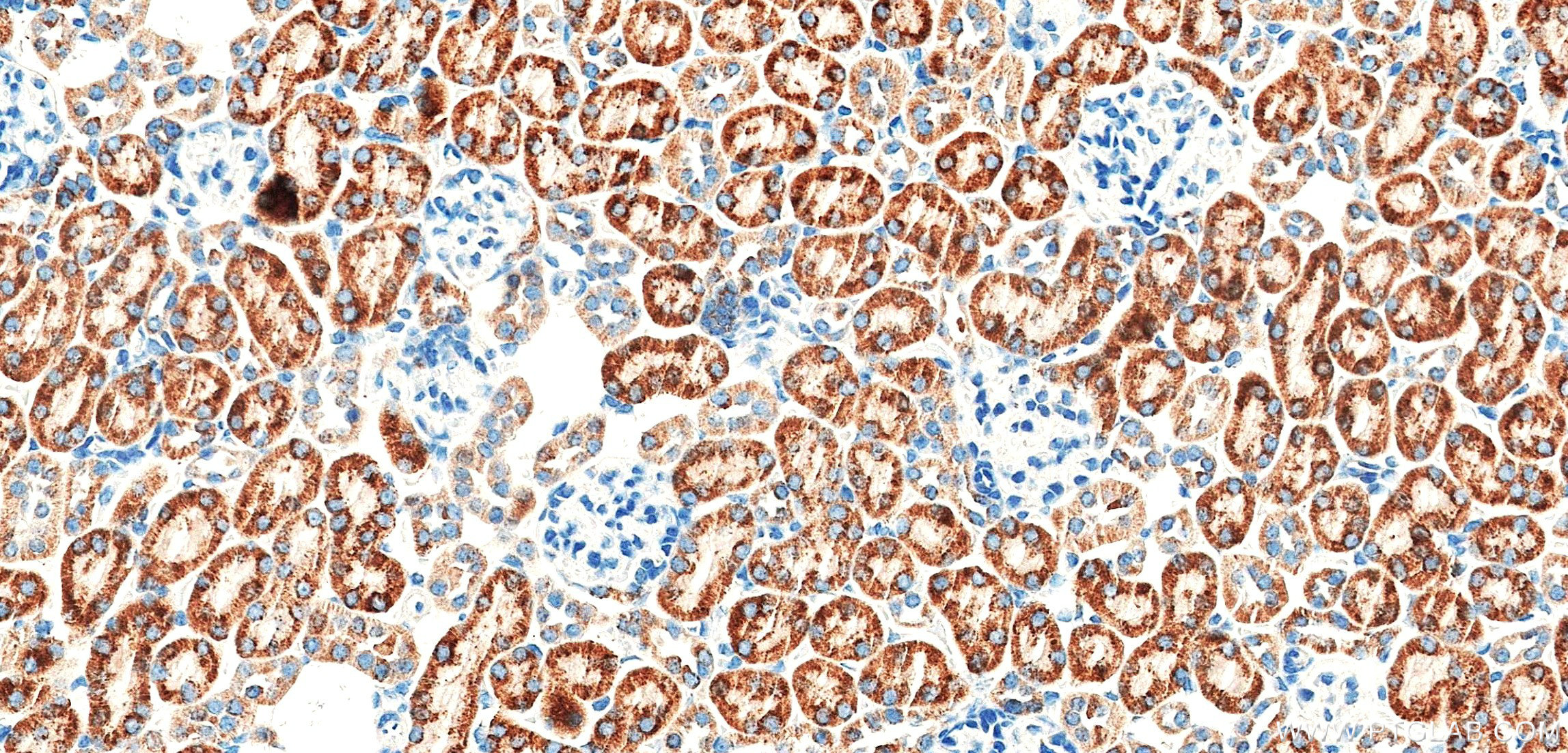 IHC staining of mouse kidney using 87791-1-RR IHC staining of mouse kidney using 87791-1-RR