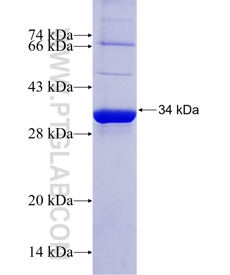SDHB fusion protein Ag29868 SDS-PAGE