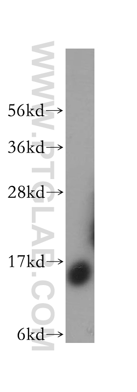 SDHC Polyclonal antibody