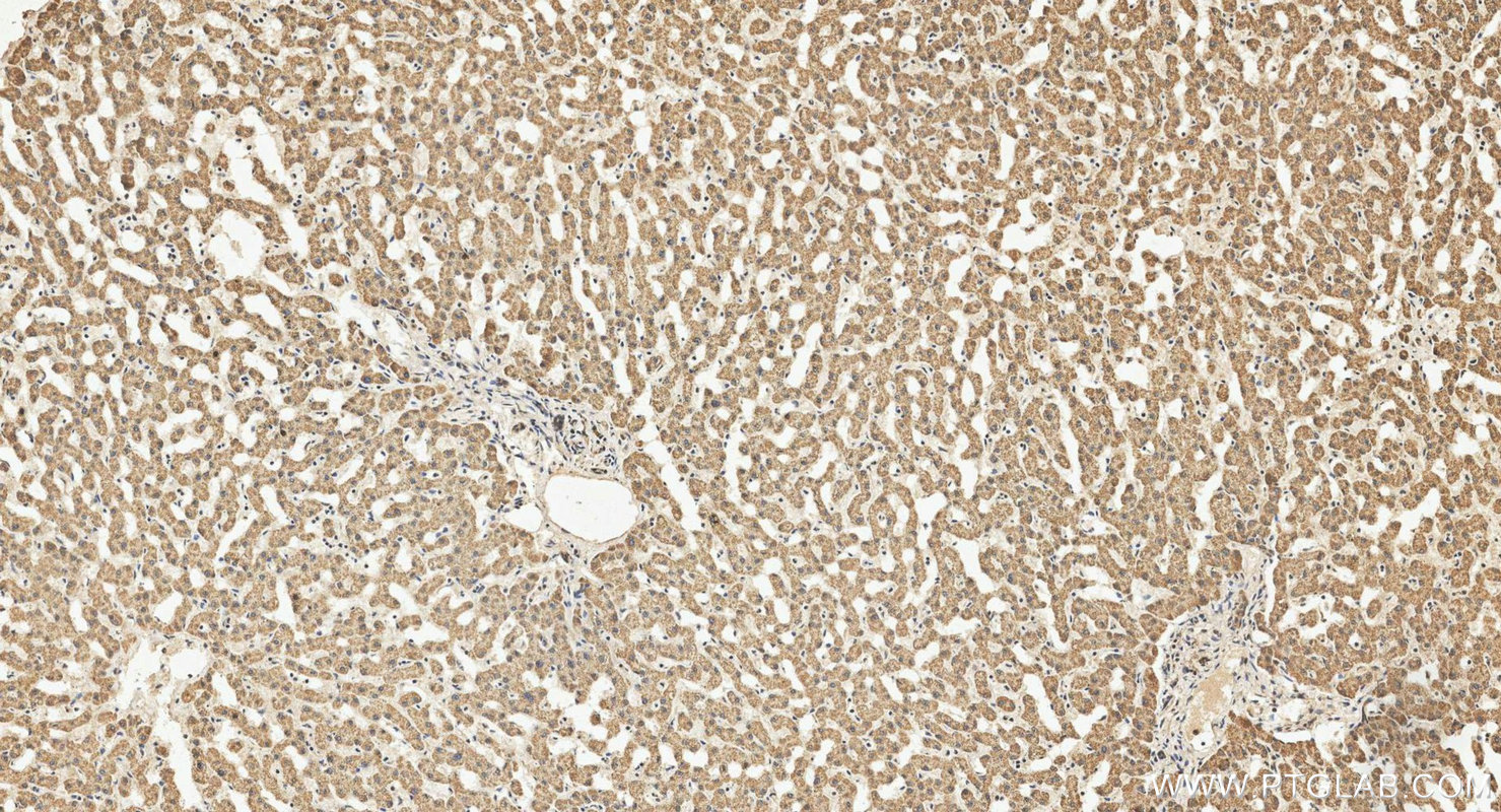 IHC staining of human liver using 26519-1-AP IHC staining of human liver using 26519-1-AP